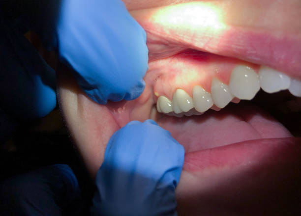 Best Emergency Broken Tooth Repair in West Falmouth, MA