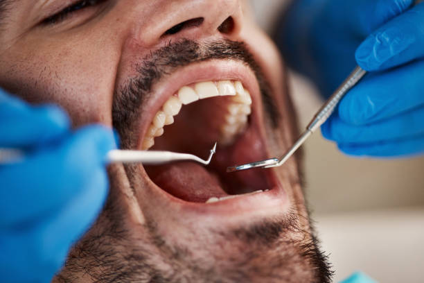 Fast & Reliable Emergency Dental Services in MA
